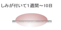 しみが付いて１週間～10日