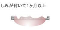 しみが付いて１ヶ月以上