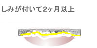 更に古いしみもできる限り目立たなくします。